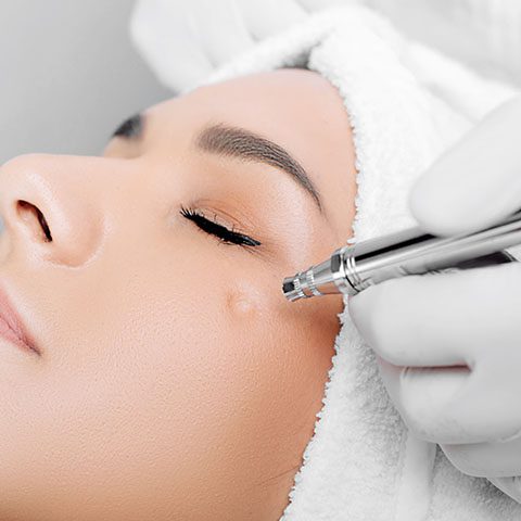 jet peel facial treatment by licensed esthetician